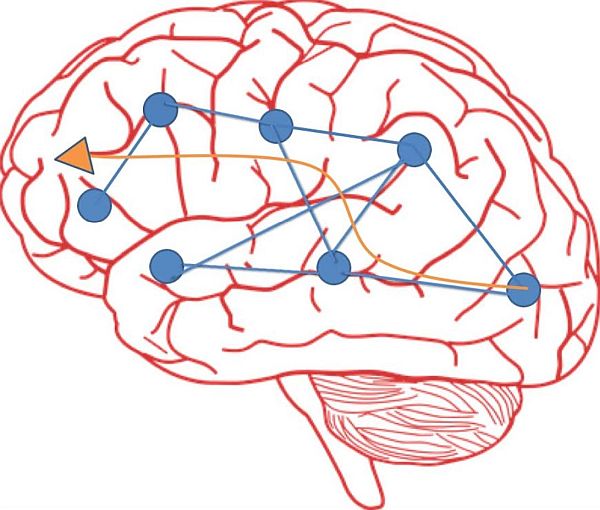 L’activité cérébrale qui sous-tend nos comportements (langage, motricité, émotions...) est accompagnée d’un échange d’information intense entre des parties éloignées du cerveau. Cette information se propage à la surface du cortex sous la forme d’ondes circulantes. La direction de propagation de ces ondes est illustrée ici par la grande flèche orange. Il y a des endroits spécifiques du cortex qui émettent, reçoivent et traitent l'information, qu’on appelle des épicentres (ronds bleus). Ils sont spécifiques à chaque personne. Les ondes peuvent se rencontrer et changer de direction. La neuromodulation mise en oeuvre dans le projet de CorStim SAS vise à remodeler les réseaux du langage en agissant sur les interactions entre les épicentres du langage tout en étant guidé par un modèle mathématique.
